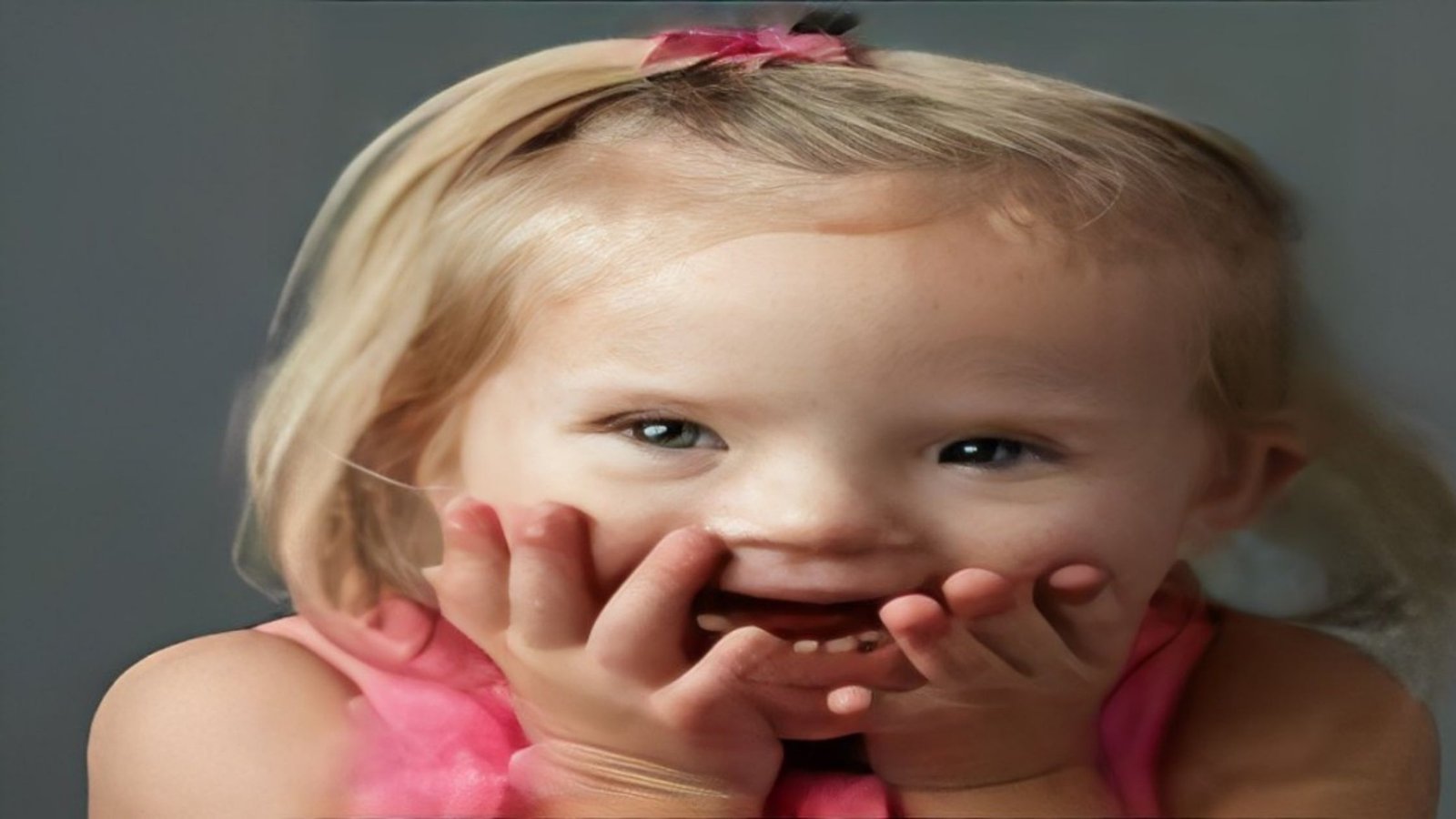 Congenital heart defects in Down’s Syndrome: Identification of a unique molecular signature
